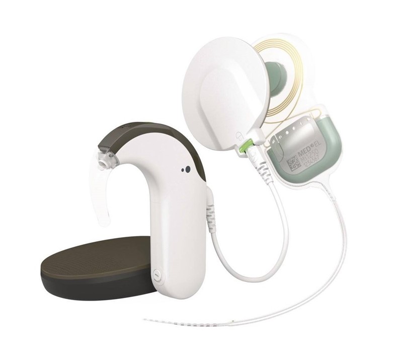 Abgabe Zuschauer ungesund kopf cochlea implantat ohne kabel Ernte Burger Methan Abgabe Zuschauer ungesund kopf cochlea implantat ohne kabel Ernte Burger Methan